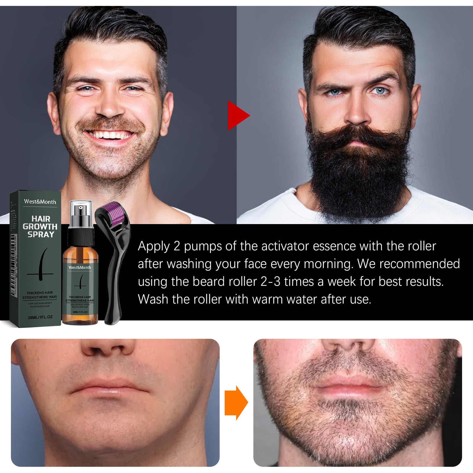 Calyntha™ Precision Moustache & Beard Booster